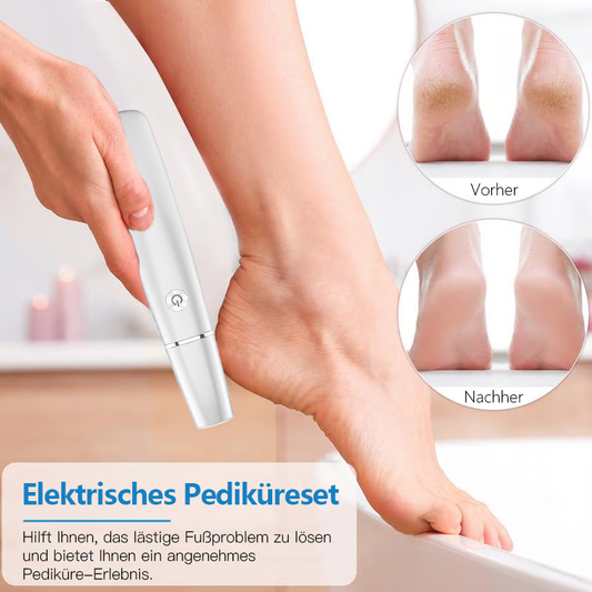 💥 Hot Sale 50% Rabatt💥Elektrischer Hornhautentferner für die Füße👣