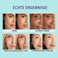 🌟KAUFEN SIE 1 UND ERHALTEN SIE 1 GRATIS🔥🎉All-in-one Feuchtigkeitscreme, Concealer & Deckkraft 💧✨ Leichtgewichtig und wasserdicht!